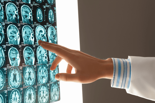 3 Powerful Stress Management Techniques for Preserving Brain Health